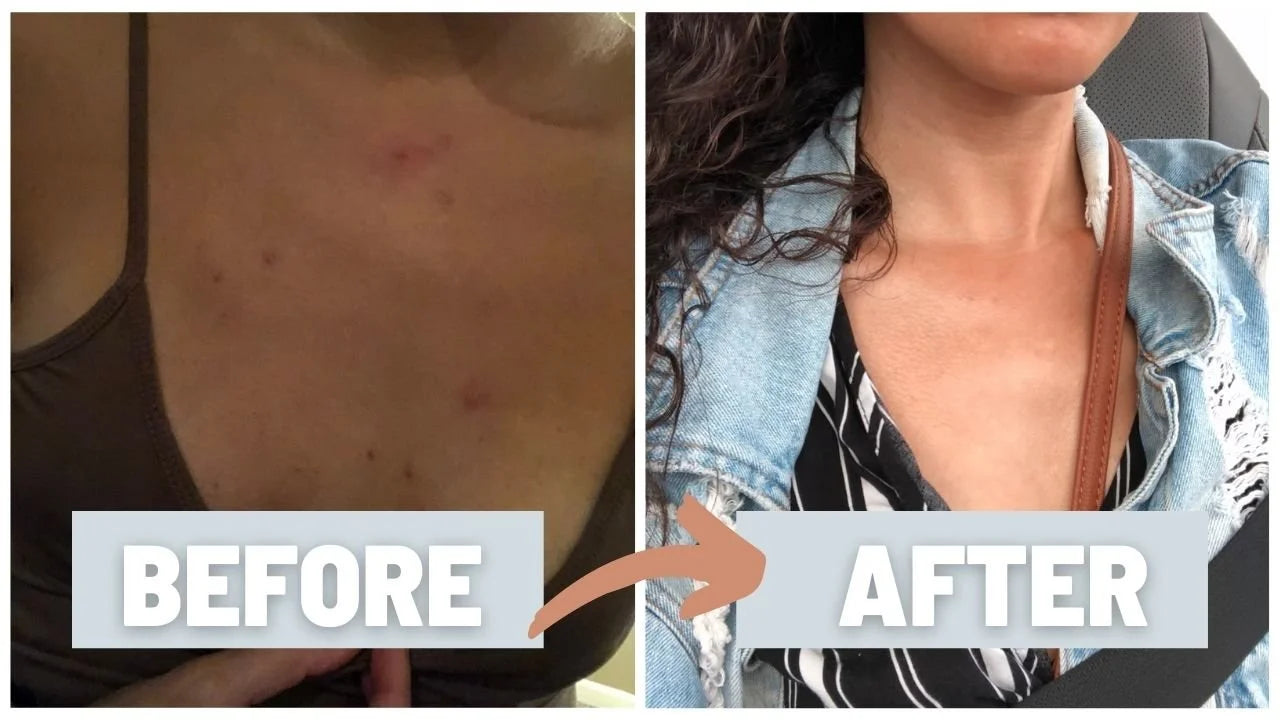 BOGO SALE! Unblurred Calming & Clearing Beauty Serum